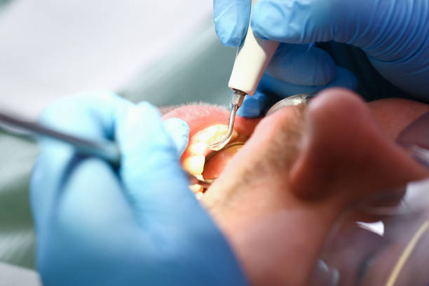 Best Emergency Dental Surgery in Morganfield, KY