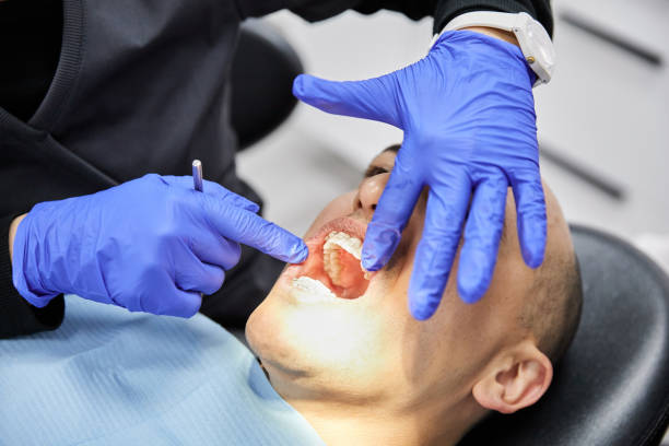 Best Emergency Root Canal Treatment in Morganfield, KY